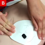 CPR Figure 17 B Apply pads on the victim